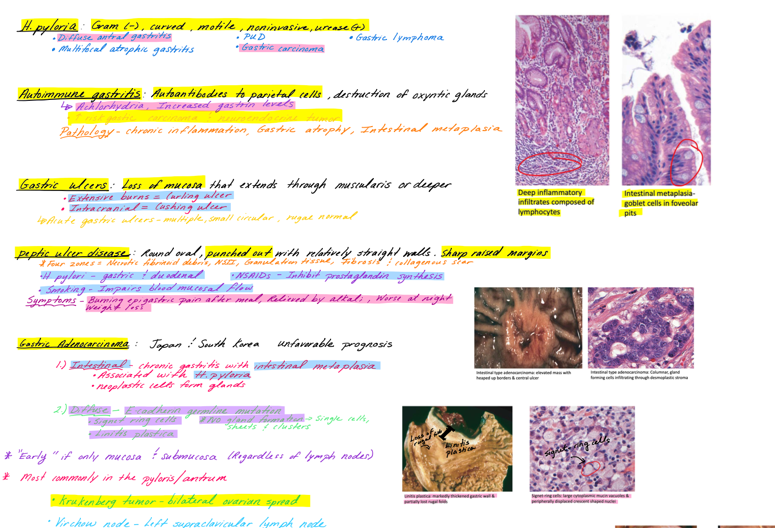 GI, Reproductive & Endocrine Pathology - Medical School Study Notes